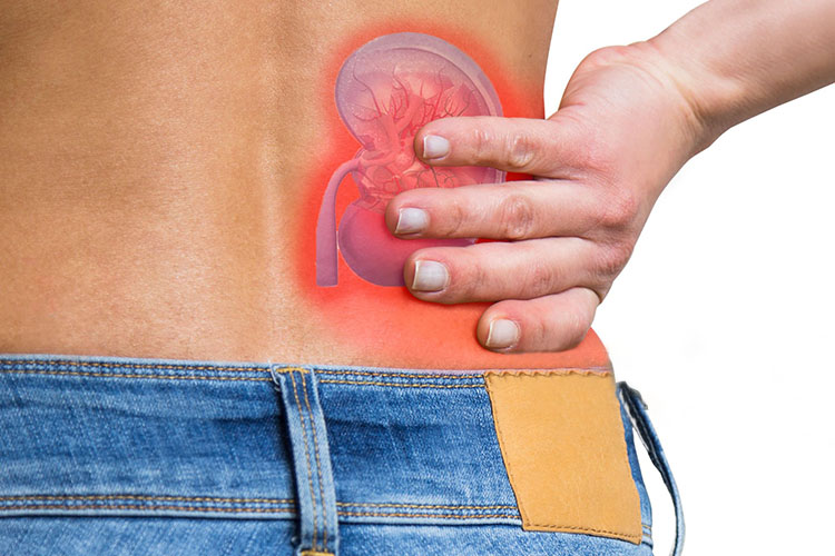 وقتی سنگ کلیه به مثانه می‌رسد؛ فرد ممکن است علائمی مانند افزایش فشار در مثانه و نیاز مکرر به دفع ادرار را تجربه کند.